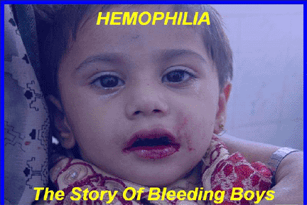 Problemes in Hemophilia